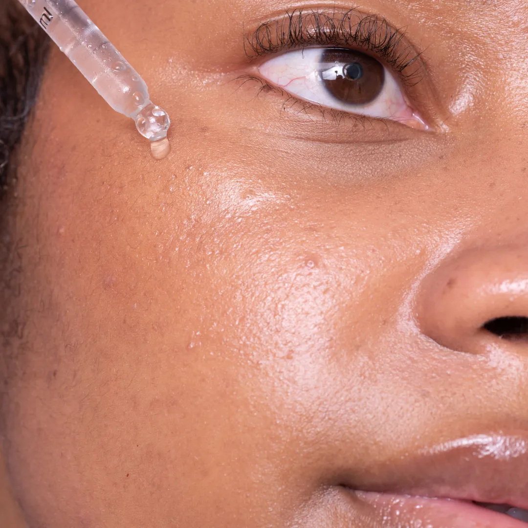 10% Niacinamide & 1% Zinc Serum