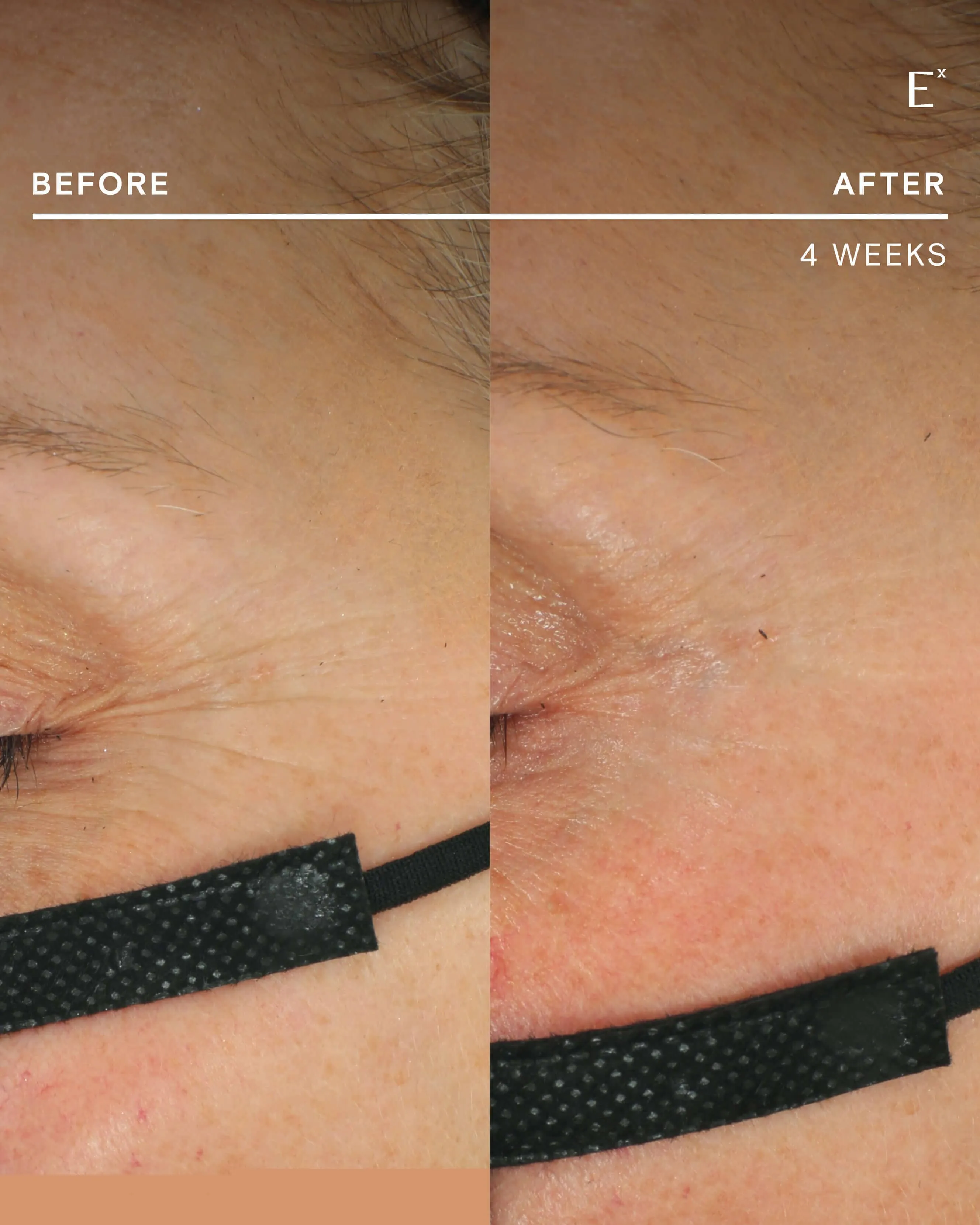 Firming Filter CoQ10 Antioxidant Powder Refill
